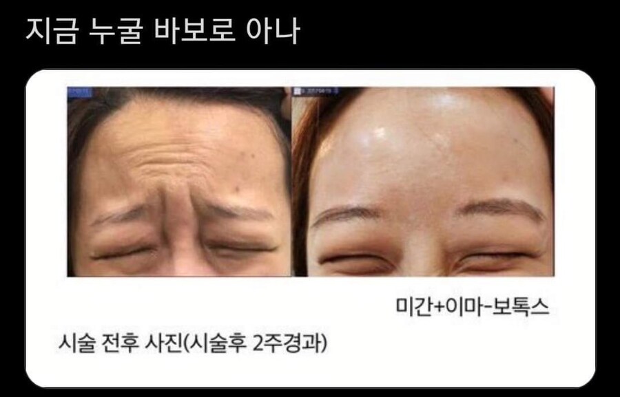 누굴 바보로 아나?_1.png