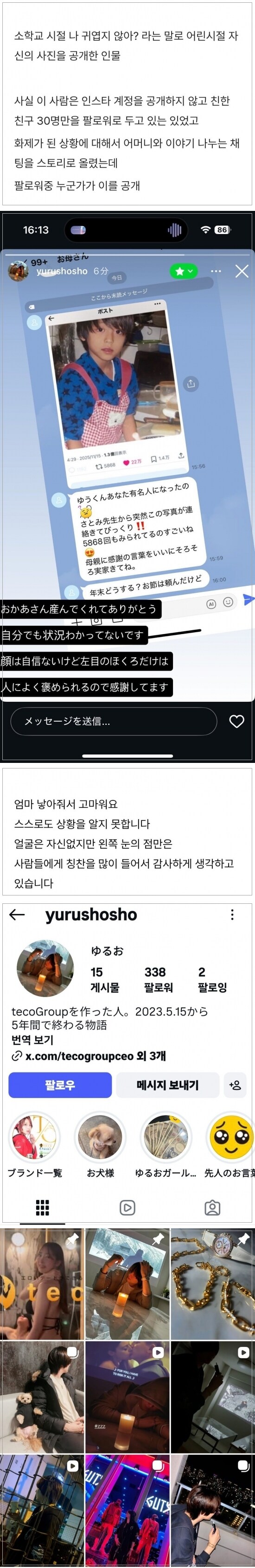 얼굴 크면서 역변했다는 일본인_2.jpg