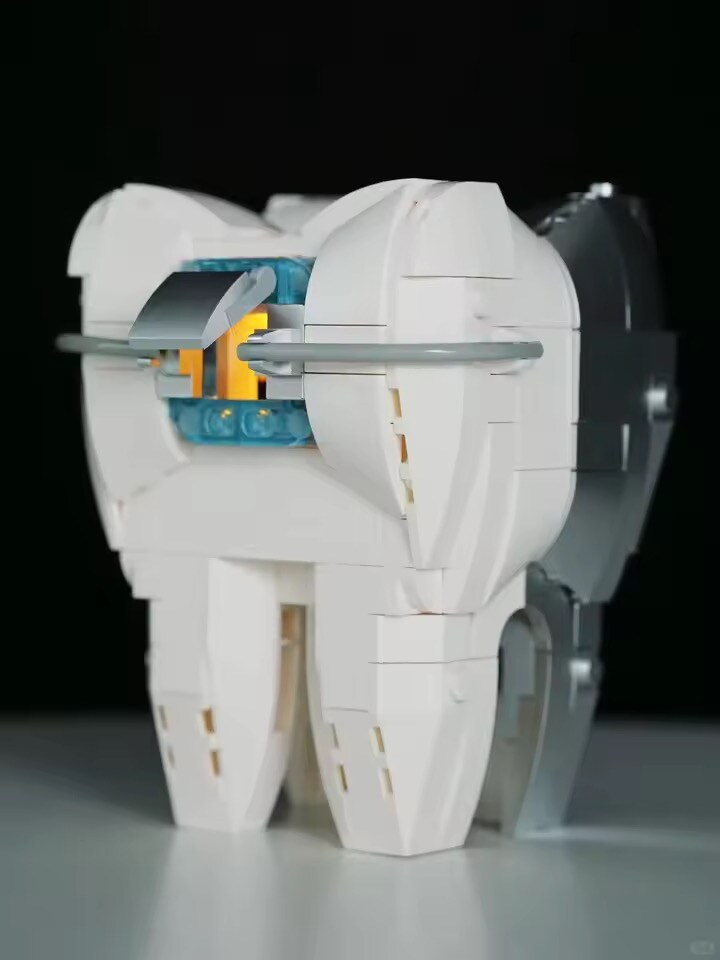 중국 짭 레고 근황.dental_5.jpg