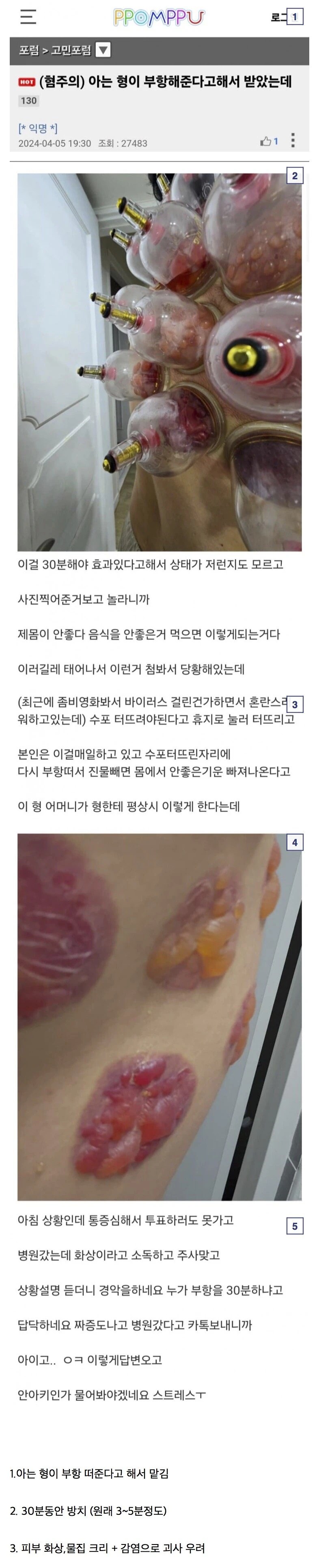 극혐주의) 무면허시술이 위험한 이유.jpg_1.png