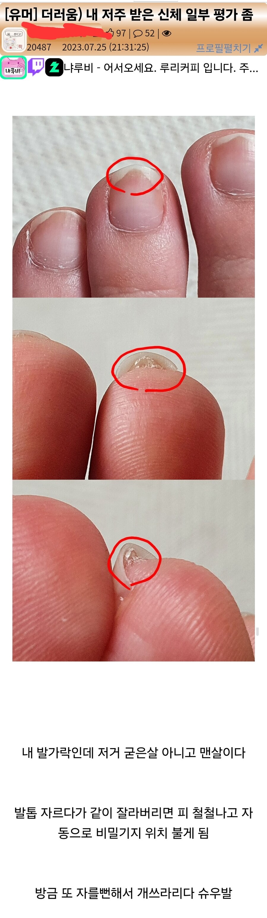 혐)비밀기지 자유이용권 끊어주는 저주받은 발톱.jpg_1.jpg