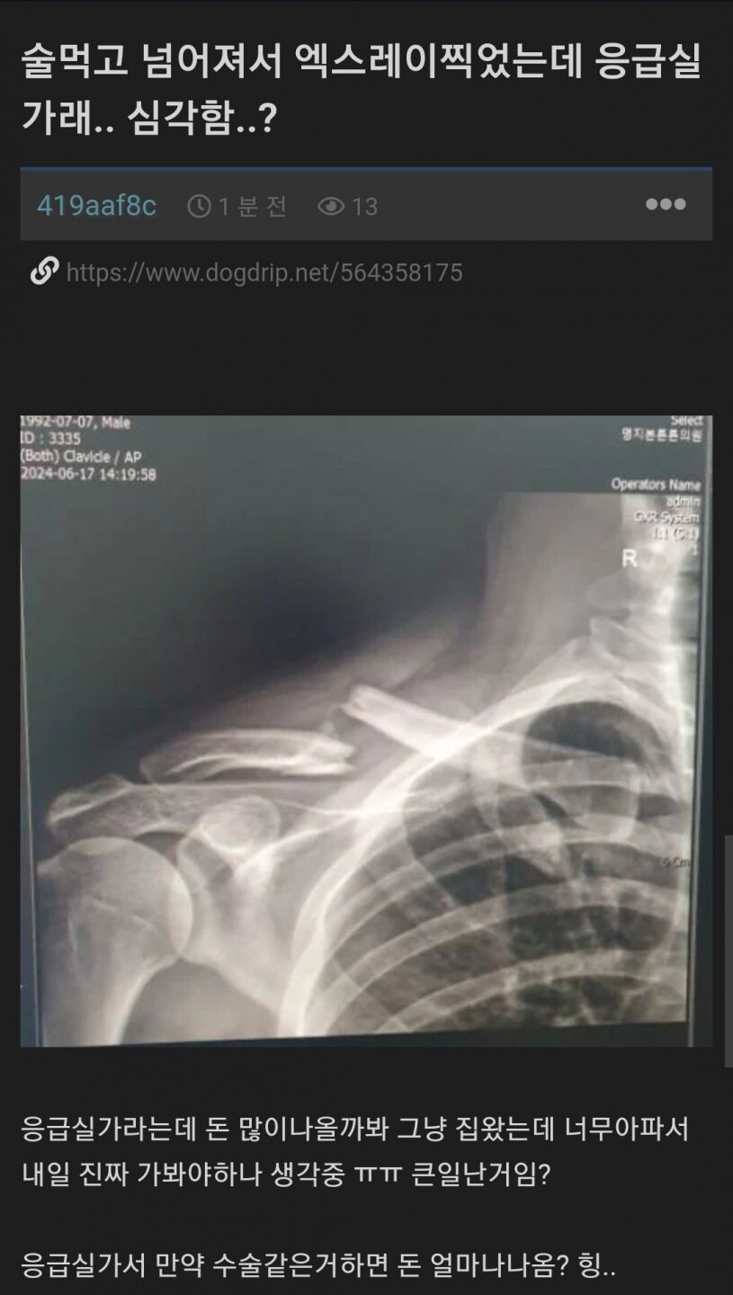 술 먹고 넘어져서 엑스레이 찍었는데 응급실가래_1.jpg