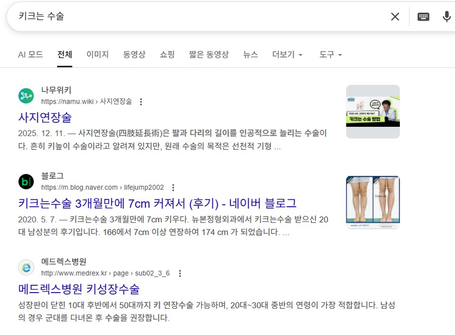 의학) 부작용없는 키크는 수술은 30년 후에도 안되려나_1.png