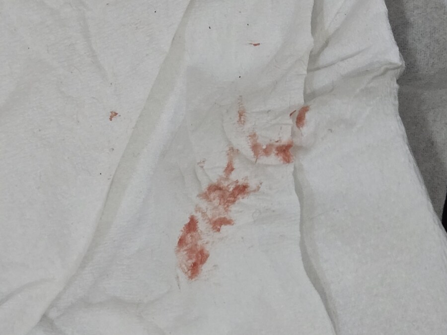 부랄 긁을 때 조심해야하는 이유_1.jpg