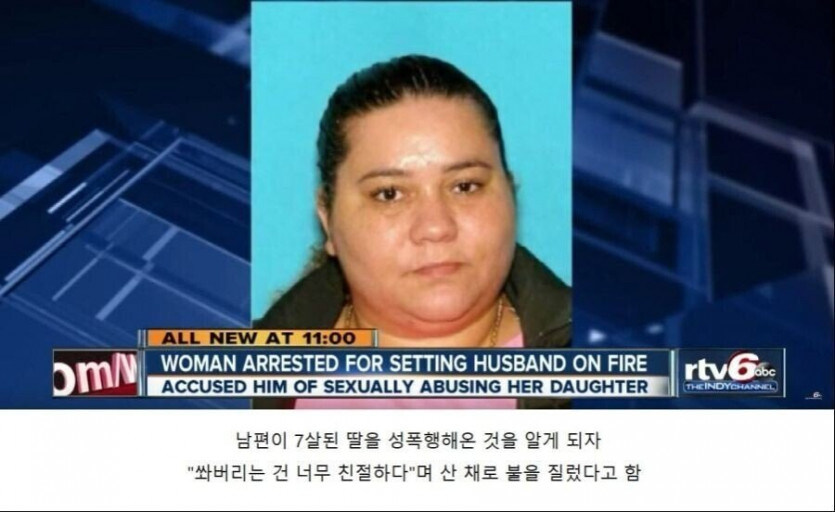 남편 몸에 불질러버린 아내의 이유...jpg_1.jpg