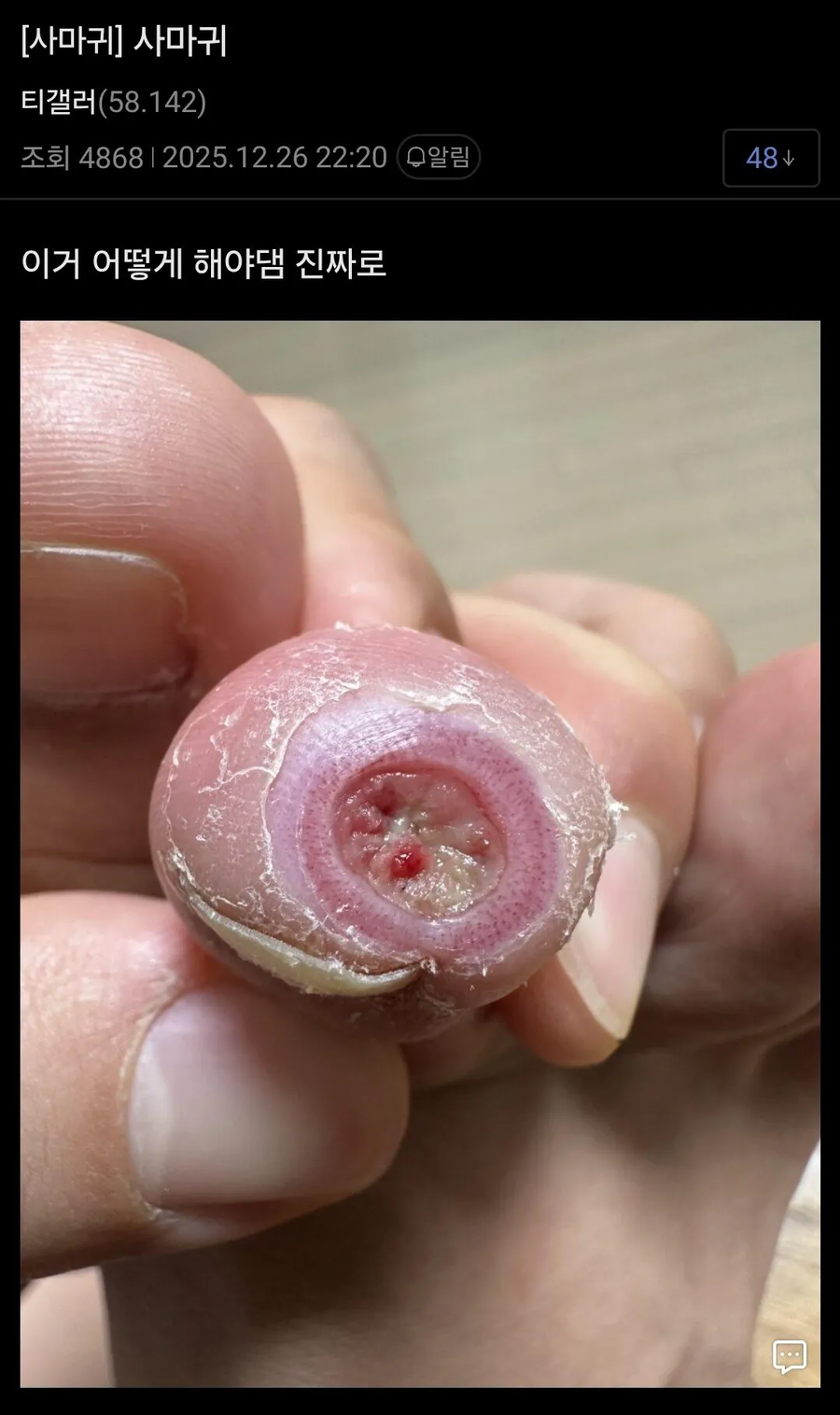 혐) 티눈갤러리 칠성장어 갤주 근황.jpg_3.webp