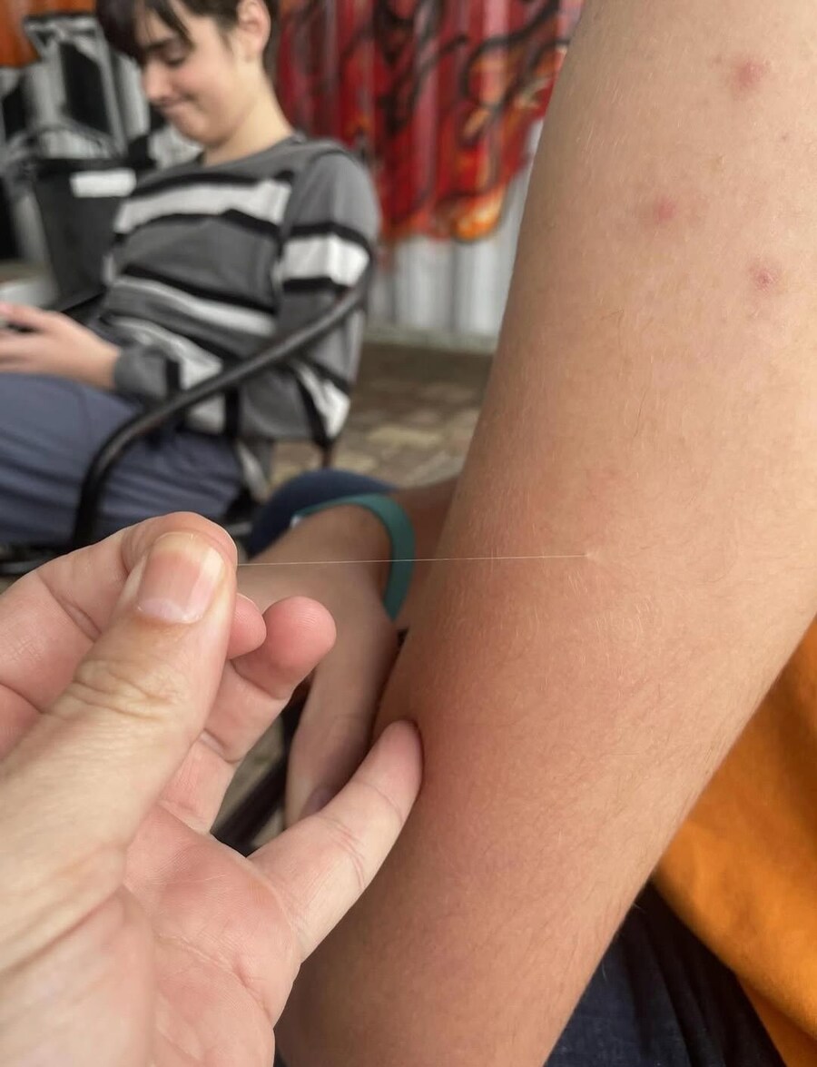 가끔 얼굴이나 몸 만질때 잡히는 그거_1.jpg