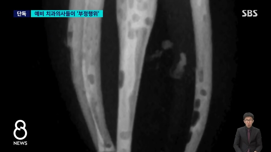 예비 의사들의 놀라운 '포토샵'…"잘 해보려고" 연세대 또 '발칵'_3.png