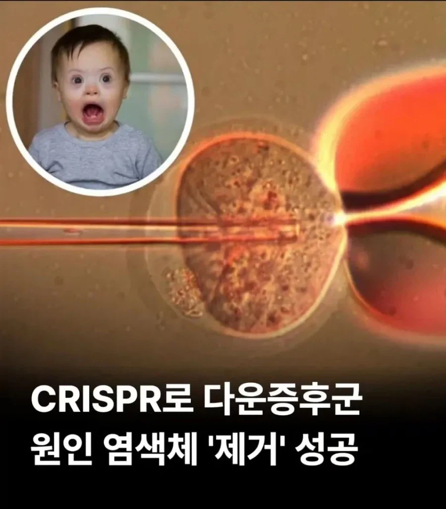 다운증후군 21번 염색체 제거 성공_1.webp