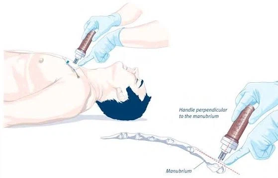 쉽게? 수액을 넣는? 방법_4.webp