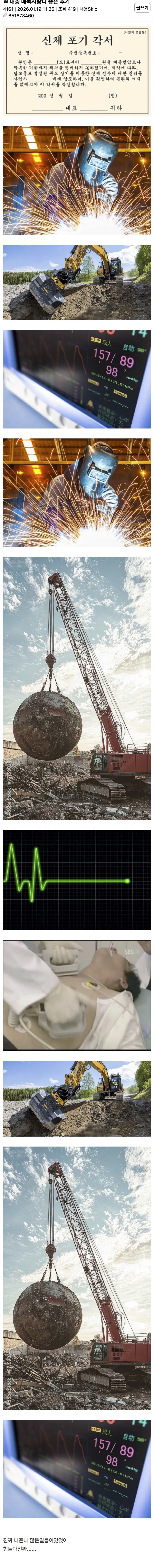 매복 사랑니 뽑은 후기.jpg_1.webp