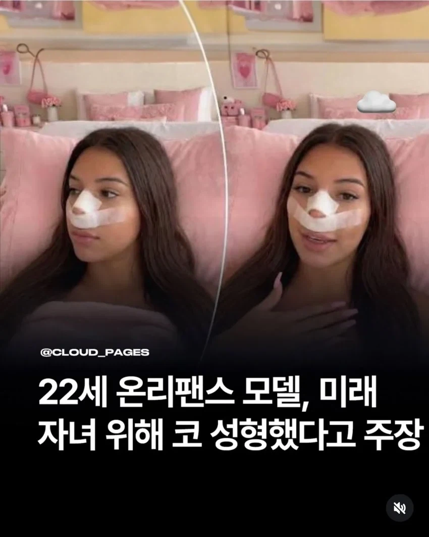 온리팬스 모델 "미래의 자손들을 위해 코성형했다"_1.webp