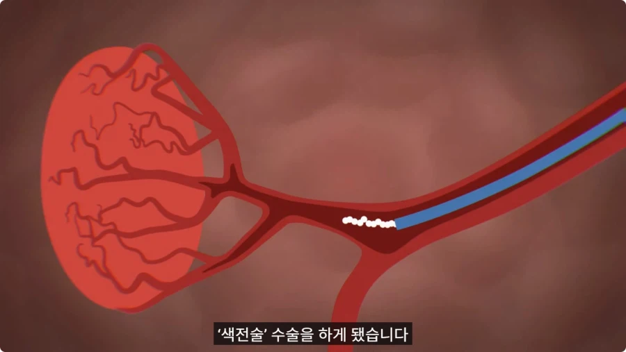 바지 벗고 거울 보며 덜렁덜렁 거리다 큰어머니한테 들킨 썰.jpg_2.webp