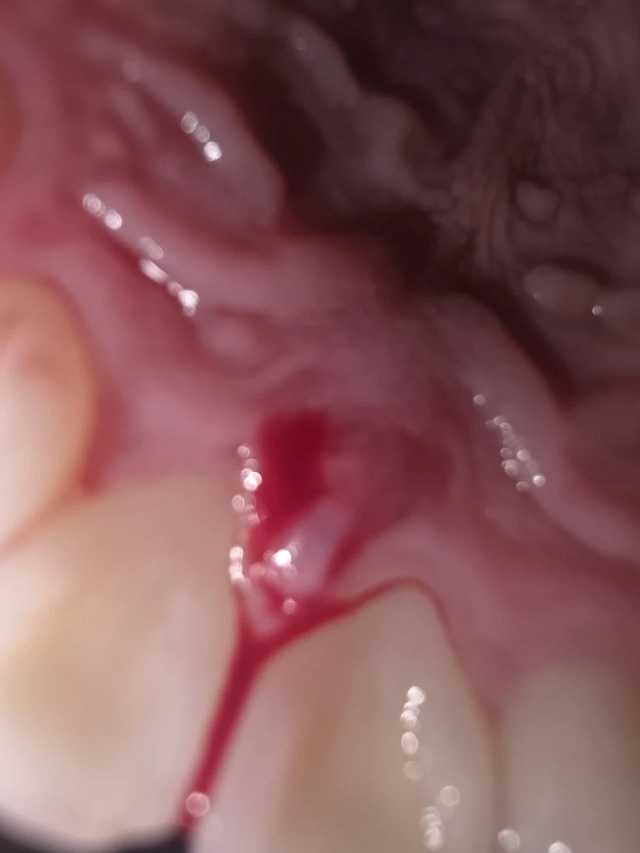 혐) 맛동산 먹을때 조심해_1.webp