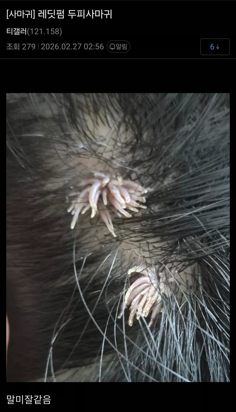 (혐) 티눈갤 근황_2.webp