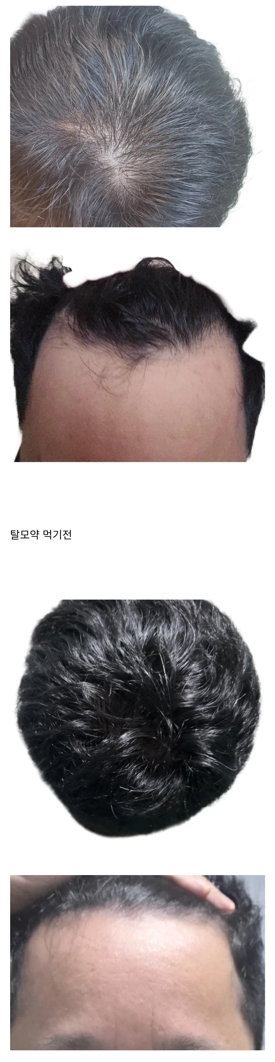 (저격)나도 남 아픈거 가지고 놀리던 새끼 저격한다_2.webp