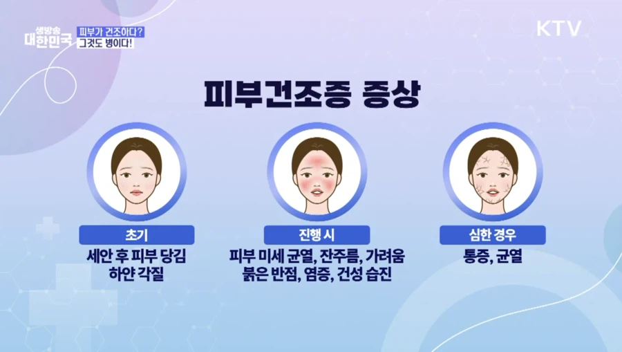 봄만 되면 긁적긁적···피부건조증·가려움증 극복법_3.webp