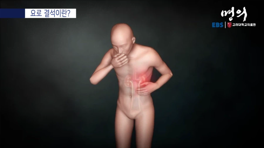 요로 결석이란?_10.webp