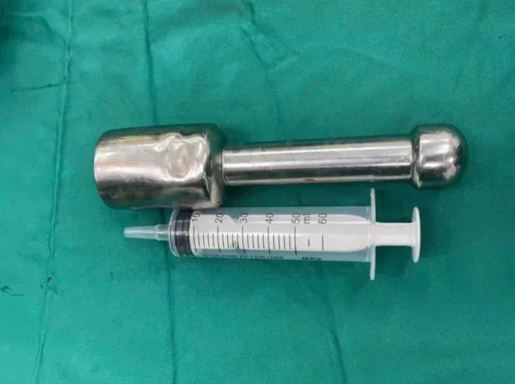 18cm 절구공이 항문에 박혀 입원한 베트남 15세 소년_3.webp