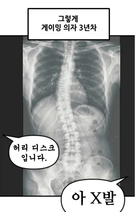 게이밍 의자에 3년 앉았더니 생긴일.manhwa_3.webp