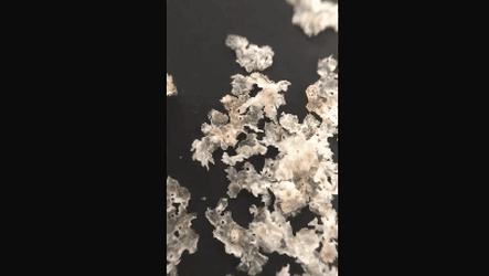 혐) 두피 각질 제거짤.mp4_4.gif