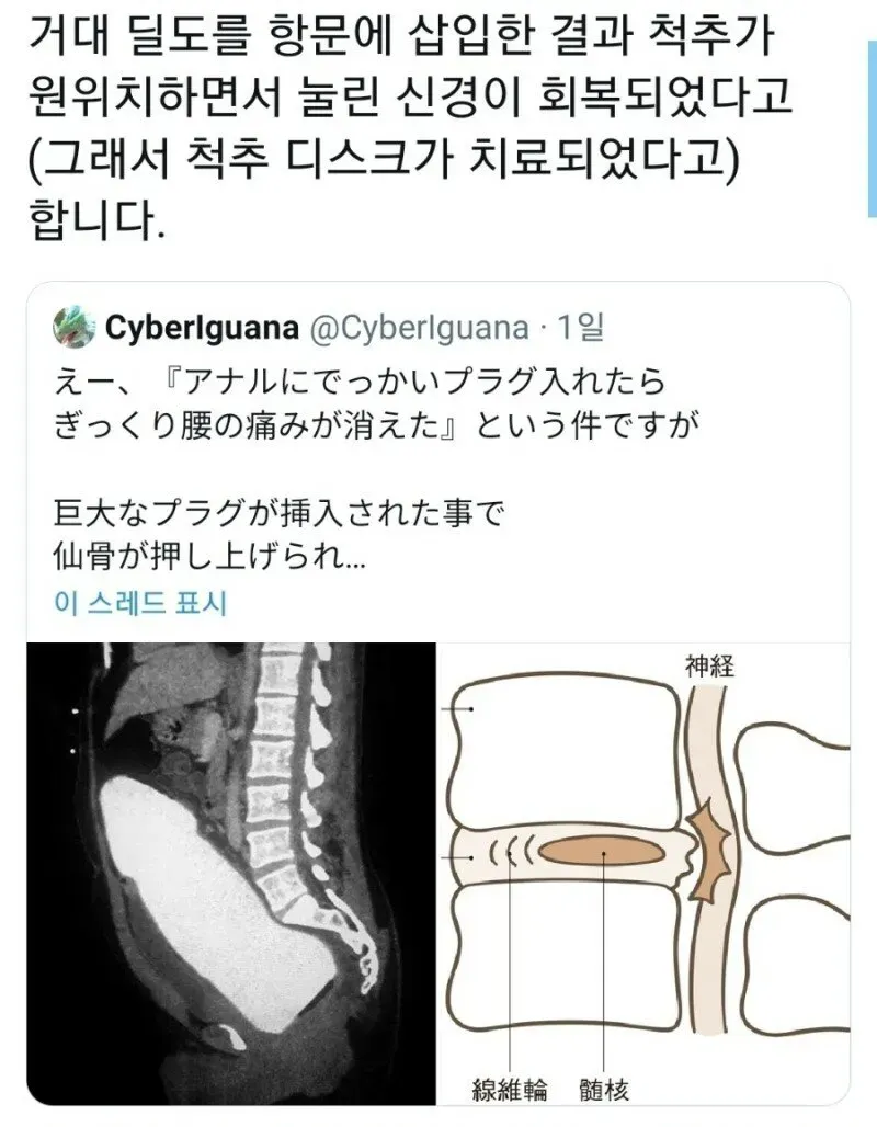 평소에 항문 자위를 즐겨야 하는 이유 | 유머 게시판 | RULIWEB