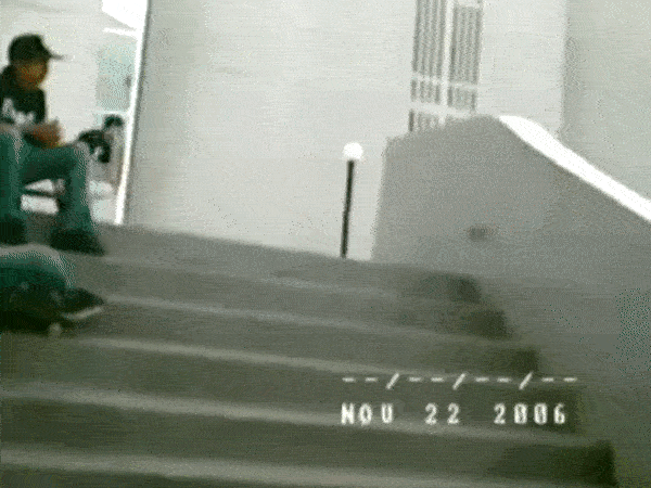 [극혐] 뼈 부러지는 짤 모음_6.gif